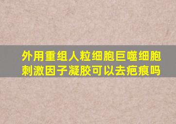外用重组人粒细胞巨噬细胞刺激因子凝胶可以去疤痕吗